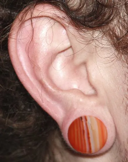 Painful Pleasures Anal Top Hat RED AGATE STONE Plug with Black Oring 8g 1 Price Per 1