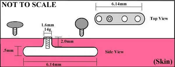 Painful Pleasures Vibrators 14g 12g Internally Threaded Screw Top Price Per 1